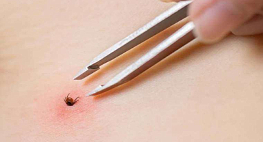 Giresun'da KKKA hastalığı şüphesiyle tedavi gören genç kız öldü