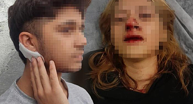 Genç kıza kaldırım taşıyla saldırıp dişlerini kırdılar