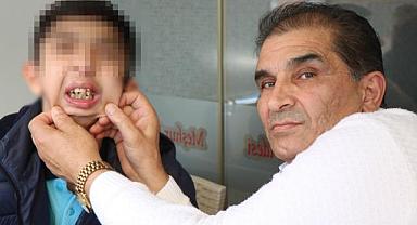 Tüm dişleri üst damağında olan lise öğrencisi yardım bekliyor
