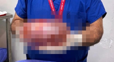 Karnından 30 santim çapında kitle çıktı... Check-up yaptırın