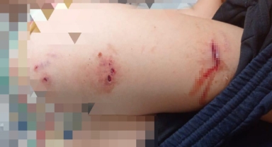 Sokak köpekleri faciaya neden oluyordu: Komşular yetişmeseydi parçalayacaklardı