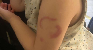 Kreşteki akılalmaz olayda öğretmenden ilginç savunma!