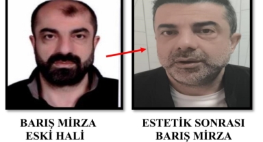 Ameliyat ile yüzünü değiştiren firari cinayet zanlısı, 7 yıl sonra yakalandı!