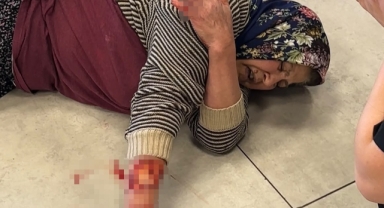 Tekmelere aldırmayan köpek kadının kolunu kopardı