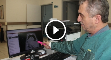 Dünyada ilk kez görüldü… 'Giresun Sendromu' tıp literatürüne girdi   