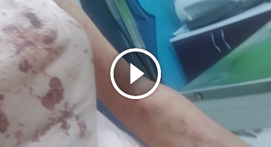 Bursa'da kangal dehşeti...O anlar kamerada